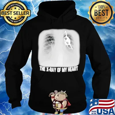 Baby yoda the x-ray of my heart s Hoodie