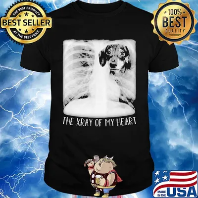 Pointer the xray of my heart shirt