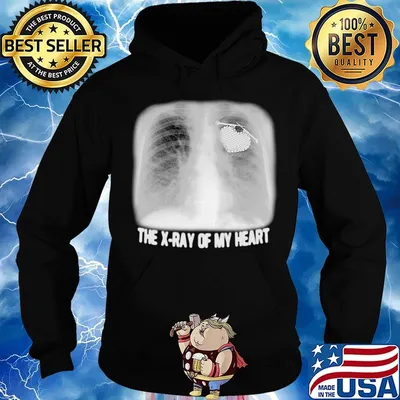 The X-ray Of My Heart Black White Shirt Hoodie