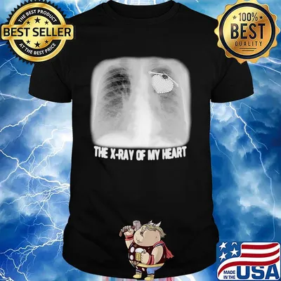 The X-ray Of My Heart Black White Shirt