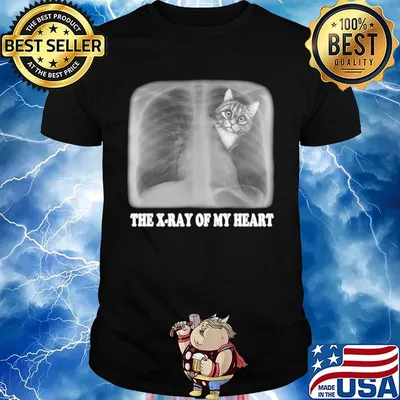 The Xray Of My Heart Cat Shirt
